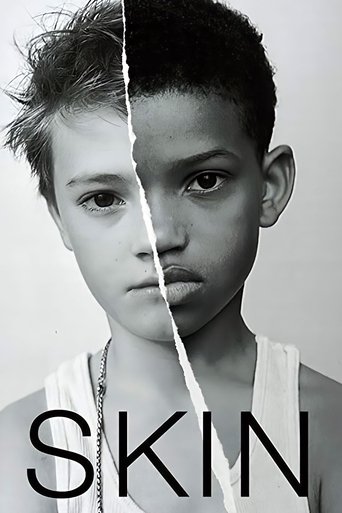 Assistir Skin online dublado e legendado