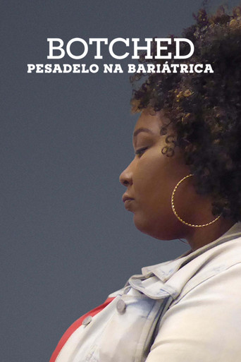 Assistir Botched: Pesadelo na Bariátrica online dublado e legendado
