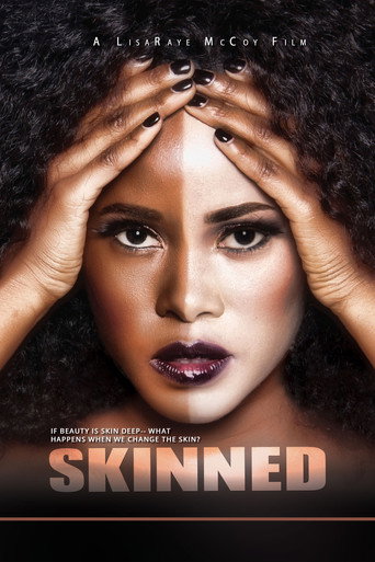 Assistir Skinned online dublado e legendado